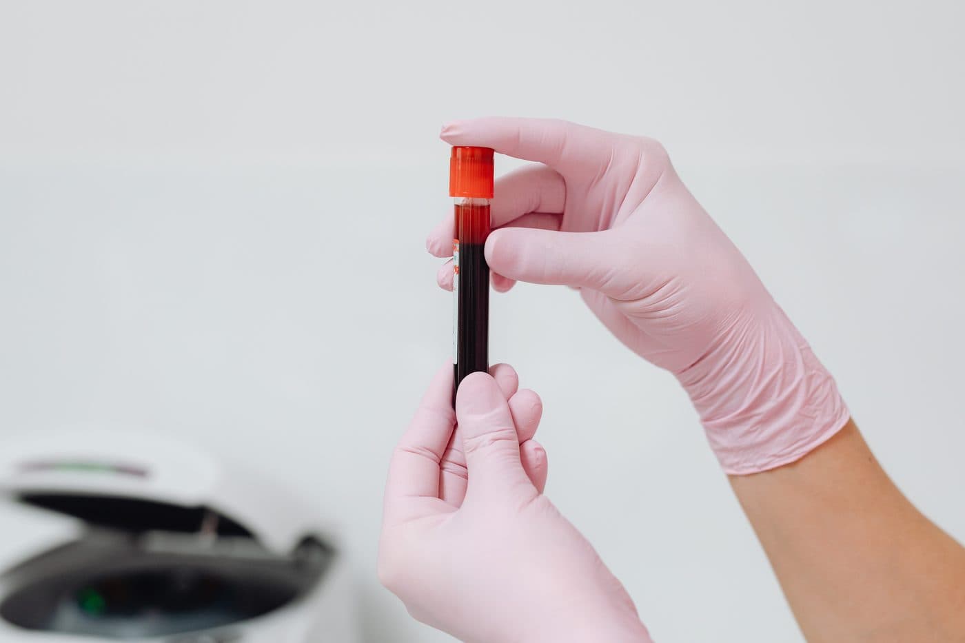 Blood sample tubes prepared for functional laboratory analysis